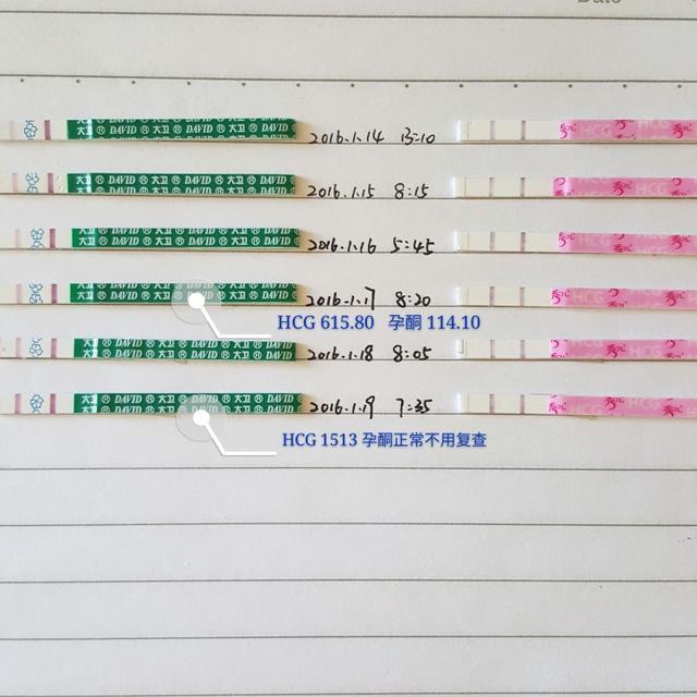 白带拉丝后多久排卵？升级的详细方法传你好孕
