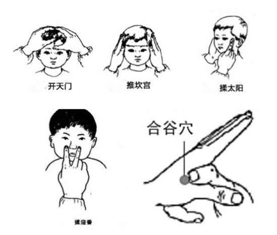 小儿鼻炎推拿手法图解 家长可试试这三种手法