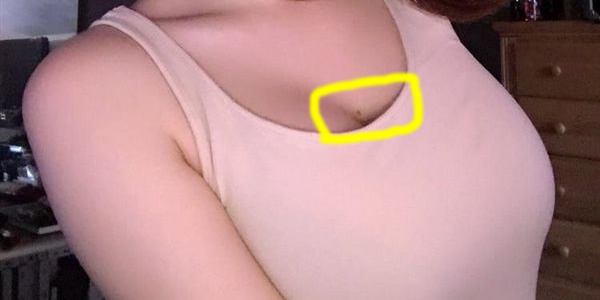 女人胸上有痣代表什么？女人胸部7位置痣的含义解读