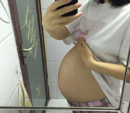 孕酮太低,这也是一个先兆流产信号,准妈妈要保胎