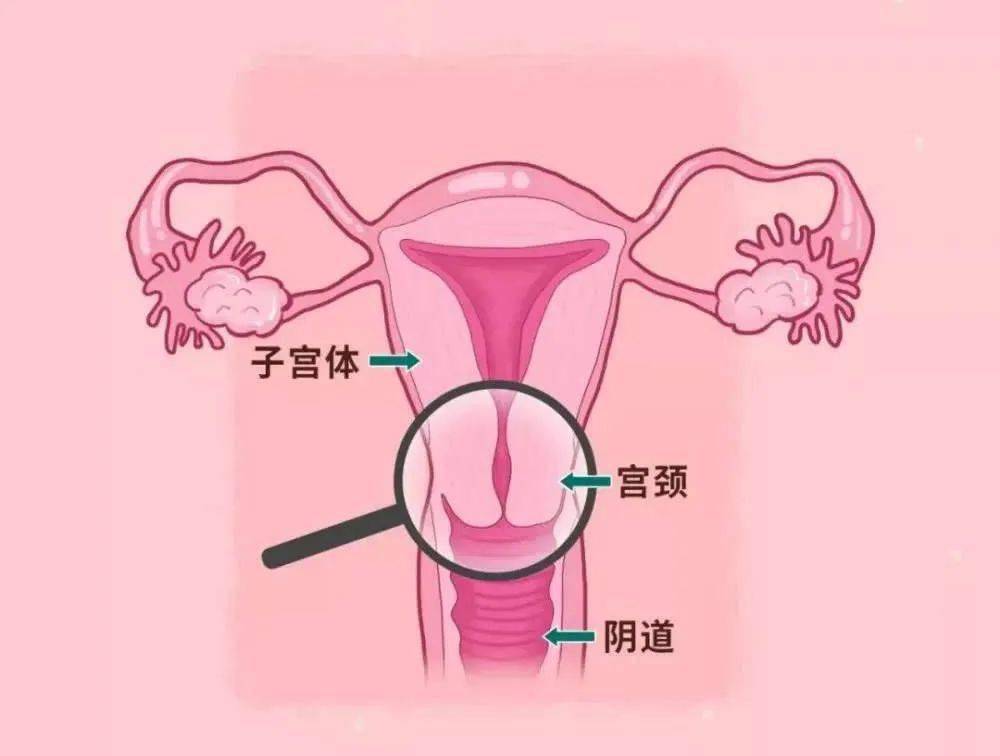 比宫颈癌更让人焦虑的,是你还不懂TA