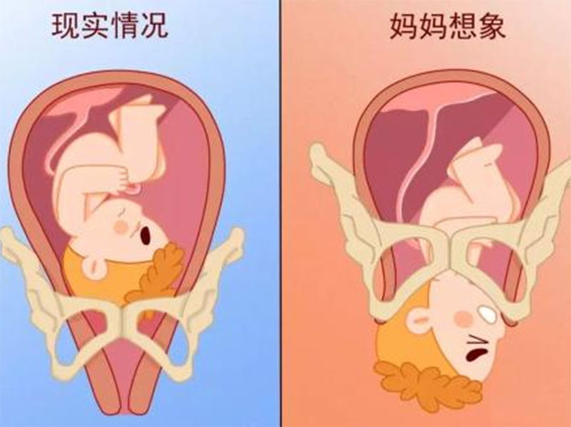 怀孕38周,下腹隐隐作痛,是胎儿入盆要生了吗？
