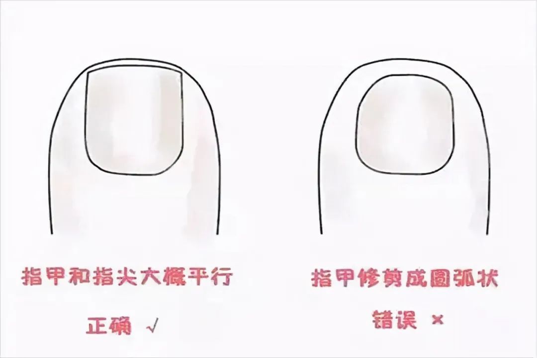 给孩子剪指甲,家长容易犯的三个错可能会伤害孩子,你要注意