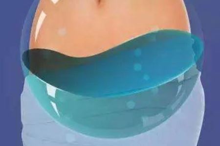 盆腔积液的治疗以及预防方法