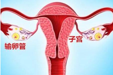 输卵管发炎的原因以及缓解的方法