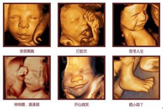 胎动是什么感觉？4个月像鱼啄,7个月像猪拱,9个月像肥猪拆猪圈
