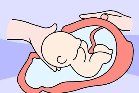 剖腹产后的两大护理方法