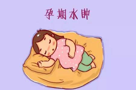孕期水肿怎么办？这些方法教你快速缓解和预防孕期水肿