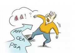 肿瘤早期五大报警信号