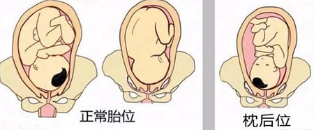 顺产生娃,医生这个动作比内检更尴尬,让产妇终身难忘