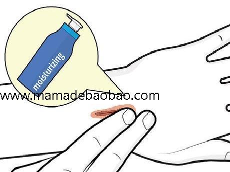 4种方法来去痂p站 - wikiHow（涂保湿霜）