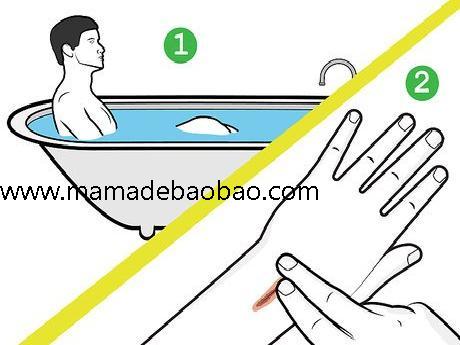 4种方法来去痂p站 - wikiHow（涂保湿霜）